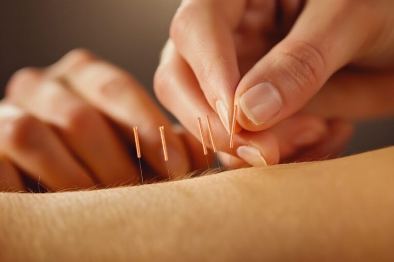 Unlocking the Power of Healing: Best TCM Acupuncture in Singapore
